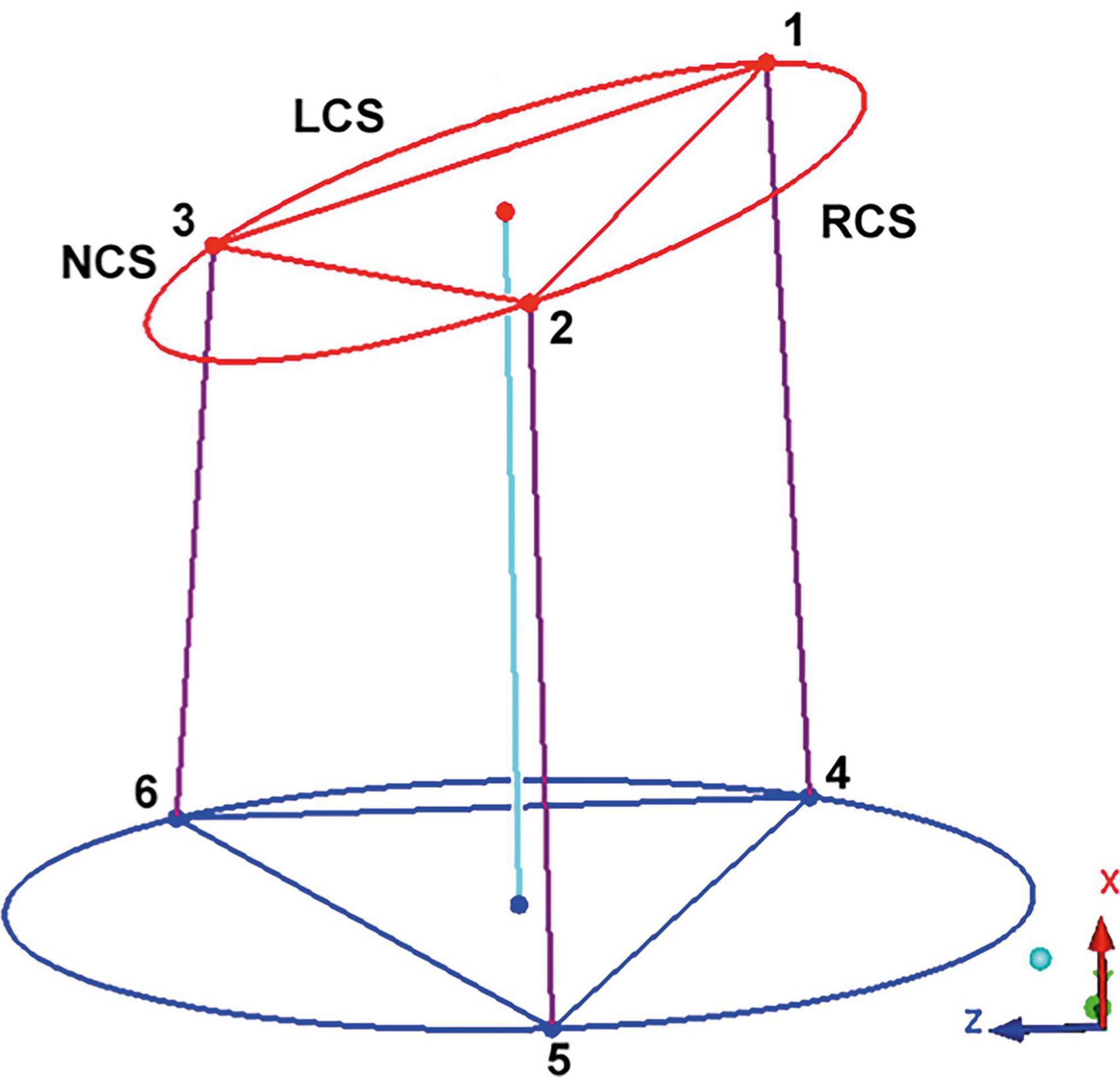 Planning of graft size and 3D reconstruction using virtual reality technique in aortic valve reimplantation